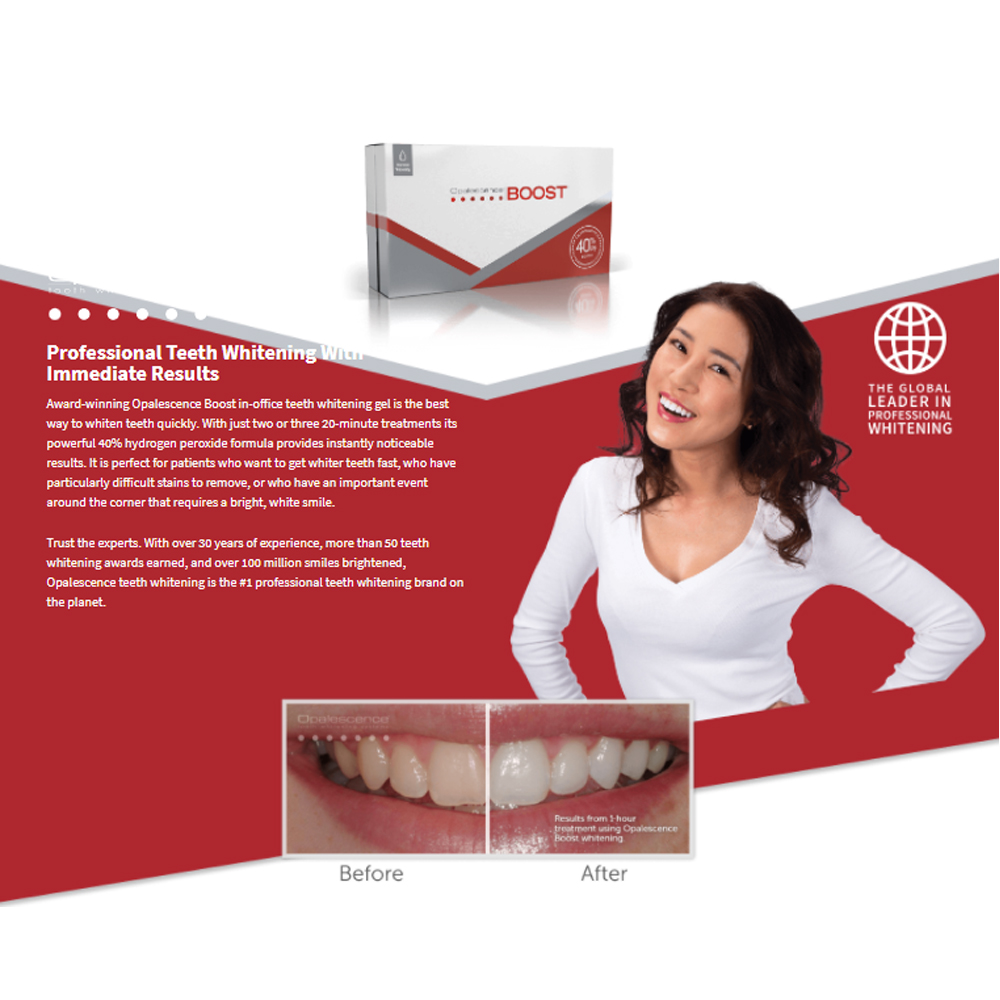 Opalescence Boost 40% PF Ameri - Teeth Whitening Opalescence recension och pris