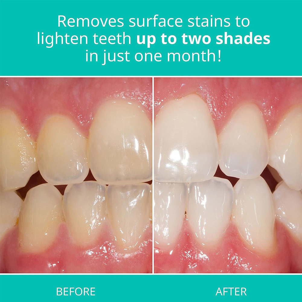 Opalescence Whitening Toothpas - Teeth Whitening Opalescence recension och pris