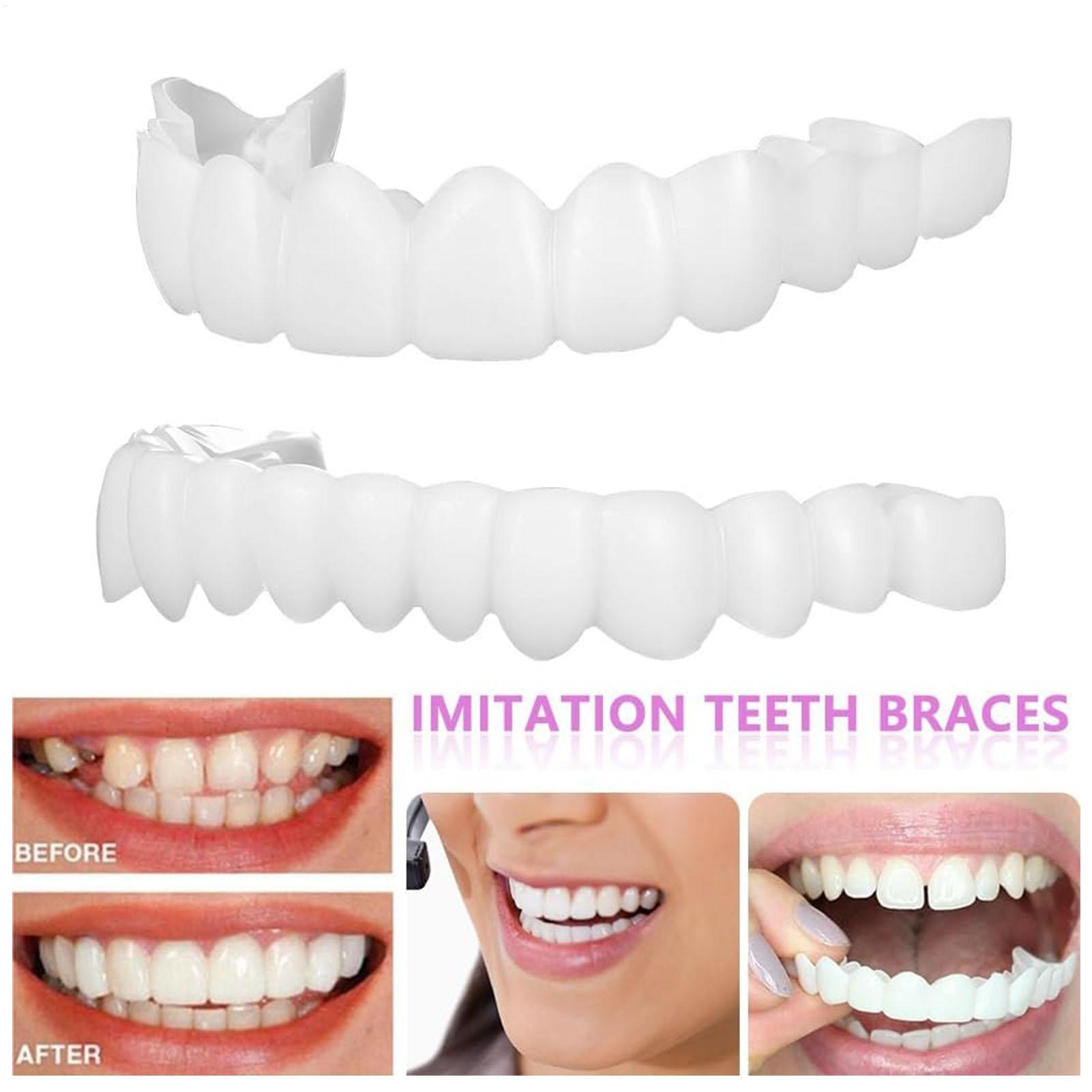 Dental Upper Lower Fake Teeth  - Teeth Whitening For Braces recension och pris