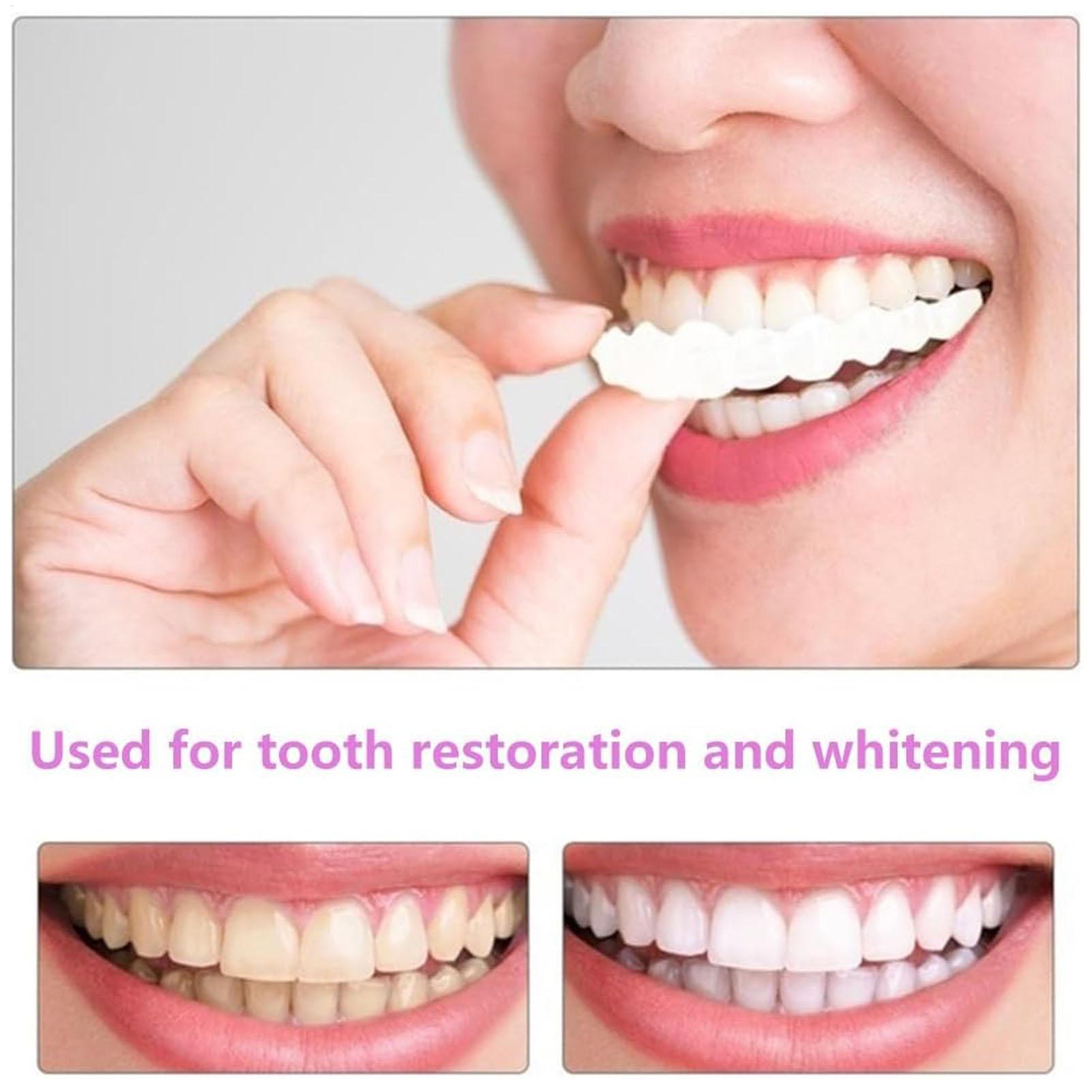 Dental Upper Lower Fake Teeth  - Teeth Whitening For Braces recension och pris