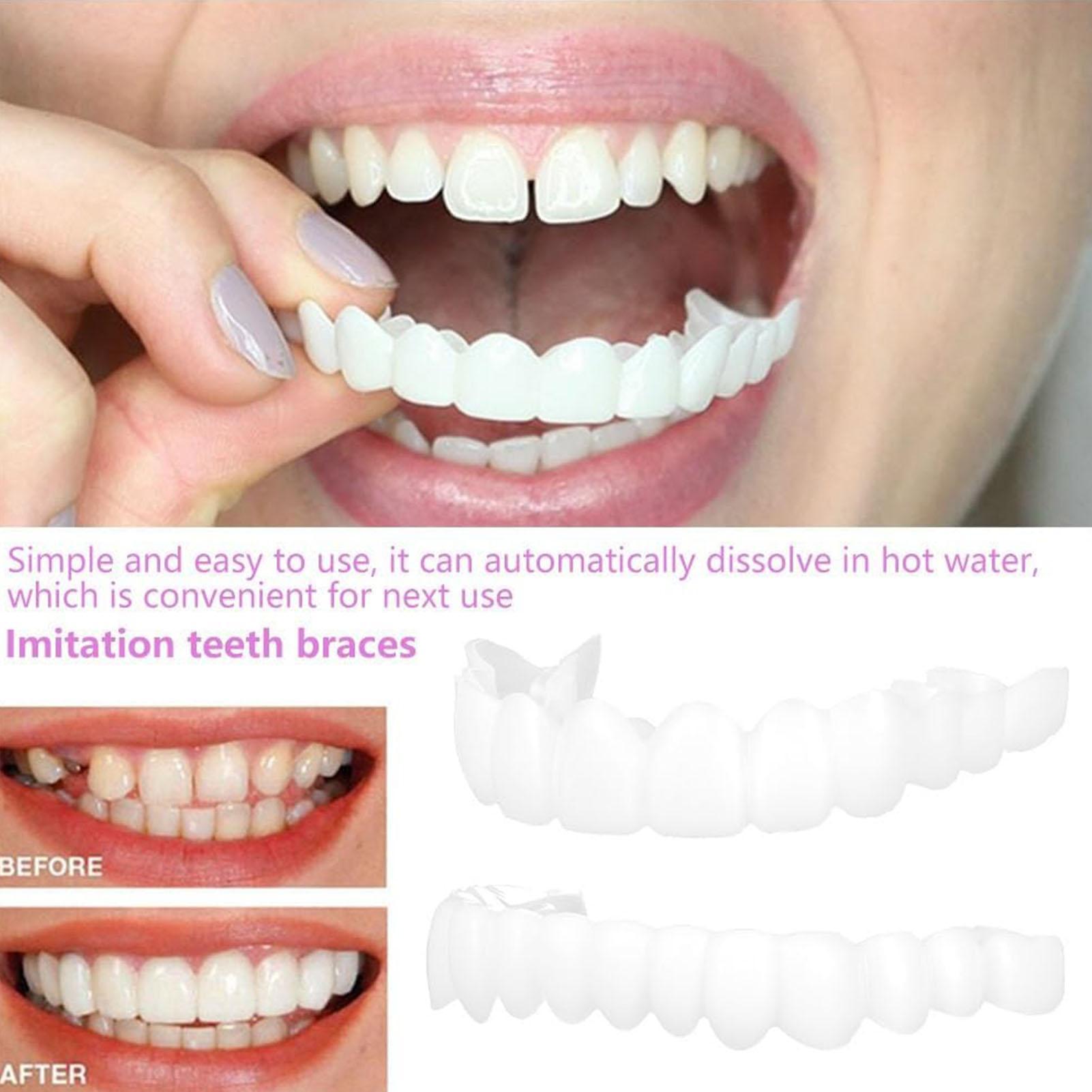 Dental Upper Lower Fake Teeth  - Teeth Whitening For Braces recension och pris