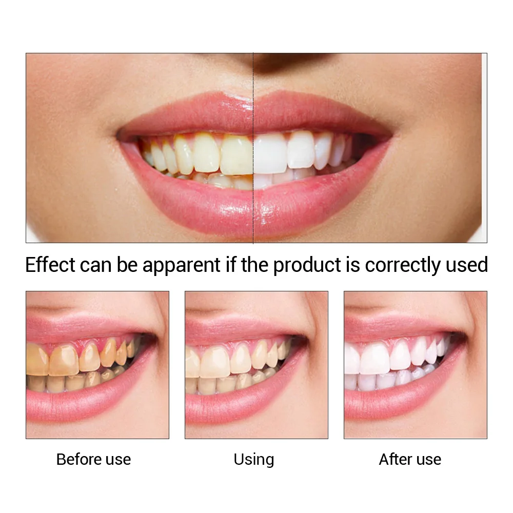 FTEENPLY Teeth Whitening Essen - Teeth Whitening Natural recension och pris