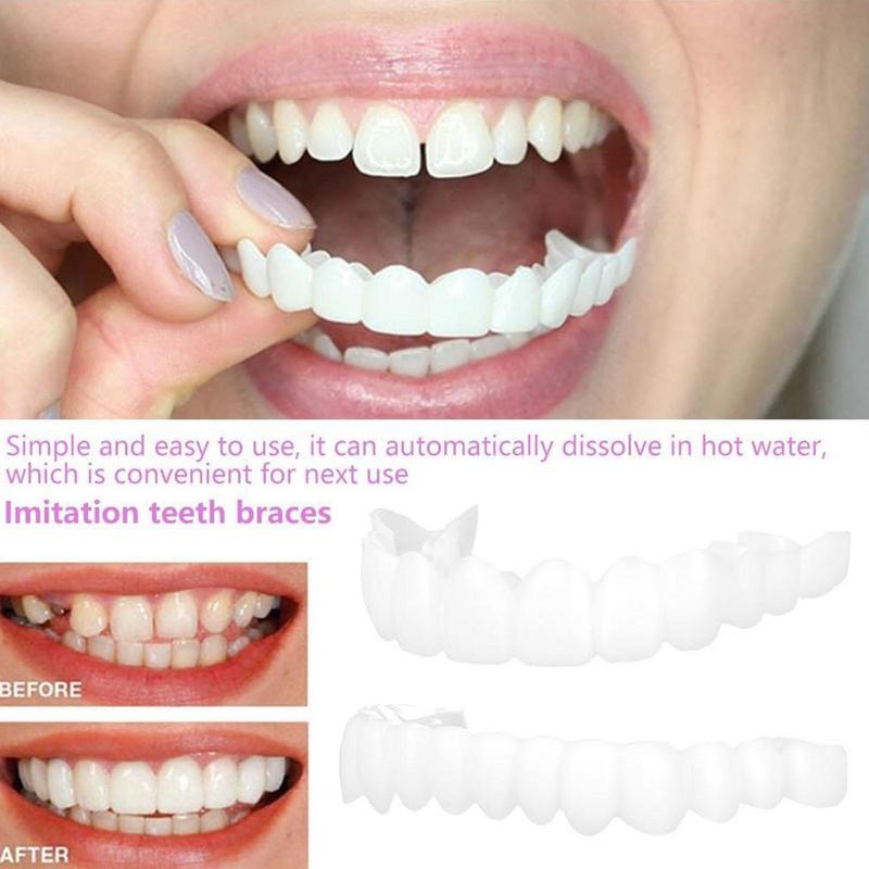 Snap On Teeth Veneers Instant  - Teeth Whitening Instant recension och pris