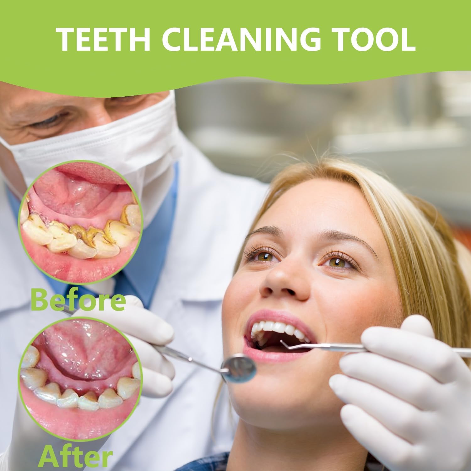 Professional Teeth Cleaning Or - Teeth Whitening Machine Professional recension och pris