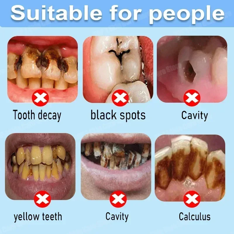 Anti Decay Toothpaste Repairs  - Teeth Whitening Uv recension och pris