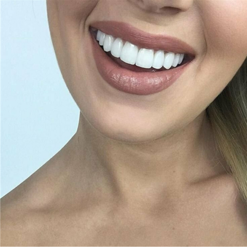 Whitening Teeth Veneers Tempor - Teeth Whitening For Braces recension och pris