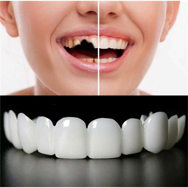 [NEW!ABMK】 2 Pairs,Regain Beau - Teeth Whitening For Braces recension och pris