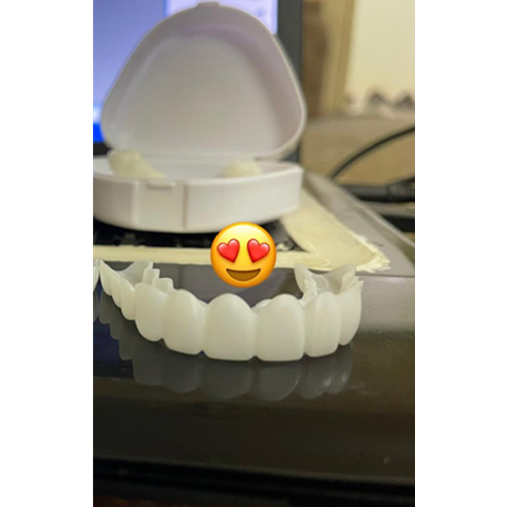 On Smile Dental Upper Lower Fa - Teeth Whitening For Braces recension och pris