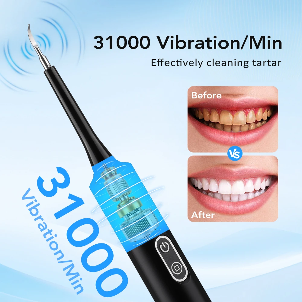 Electric Sonic Vibration Denta - Teeth Whitening Products recension och pris
